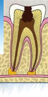 lateral