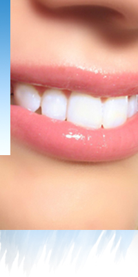 lateral